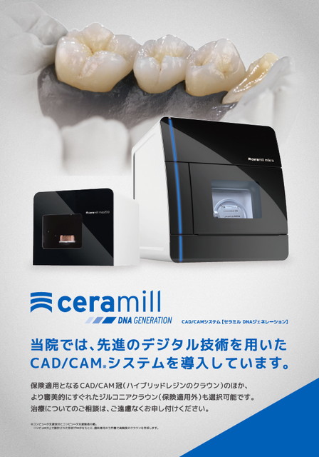 当院では最新のデジタル技術を用いたCAD/CAM®システムを導入しています。